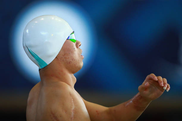 除了红眼病，男性游泳还会感染这些你想不到的疾病